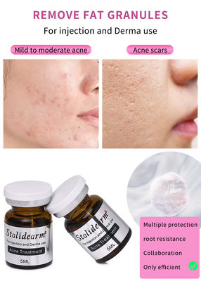 پوست تقویت کننده 5 میلی لیتر تزریق سروم تزریق Mesotherapy برای درمان آنس