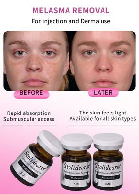 ملازما MESO سرم Mesotherapy محلول Exosomes تزریق فرانسه اصلی استالیدیام