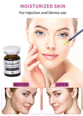 استالیدارم اسید هیالورونیک سروم تزریقی صورت برای تقویت پوست و مزوتراپی