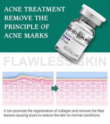 MESO LUXURY تقویت کننده پوست گیاه خالص جوش پاک سروم سفید کننده Mesotherapy راه حل برای درمان آکنه