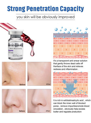 میکرونیدلینگ LUXURY Meso Serum Skin Whitening Essence 10ml جذب فوری پوست