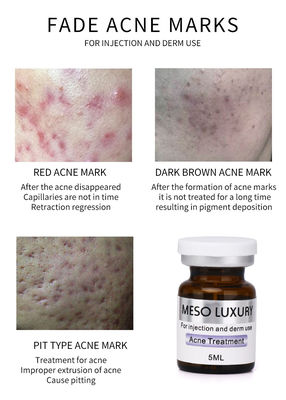 MESO LUXURY تزریق Mesotherapy راه حل Exosomes سرم لکه های قرمز درمان آکنه پوست