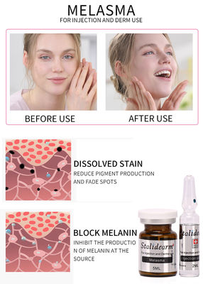 محلول تزریق مِزوتراپی مِلازما Exosome Skin Booster Botulinum Dermal Filler