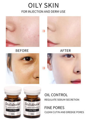 سرم تزریقی برای پوست های چرب 5 میلی لیتر/بطری ایمن ست Good Effect Essence با نام تجاری اصلی Stalidearm